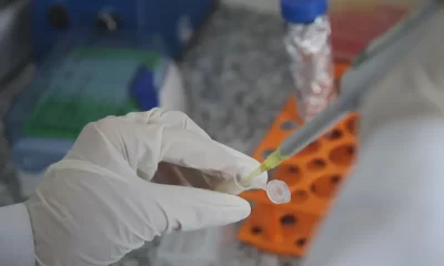 vacina-contra-cancer-de-pele-pode-estar-disponivel-em-2025,-diz-ceo-de-farmaceutica-–-folha-de-dourados-–-noticias-de-dourados-ms-e-regiao