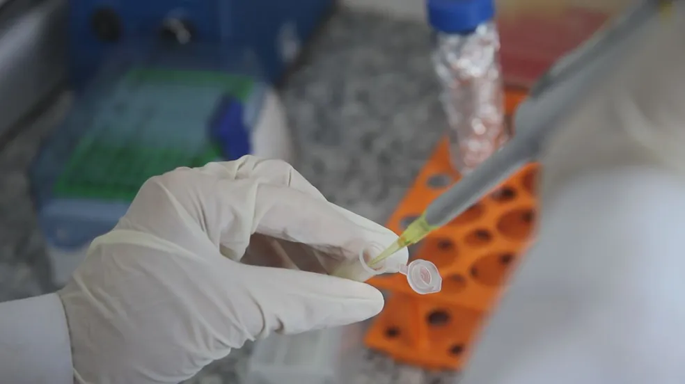vacina-contra-cancer-de-pele-pode-estar-disponivel-em-2025,-diz-ceo-de-farmaceutica-–-folha-de-dourados-–-noticias-de-dourados-ms-e-regiao