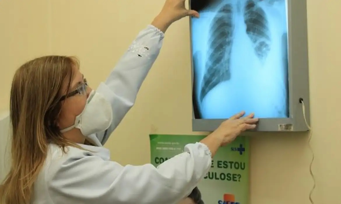 prefeitura-e-crth-intensificam-acoes-para-o-combate-a-tuberculose-em-dourados-|-portal-prefeitura-de-dourados