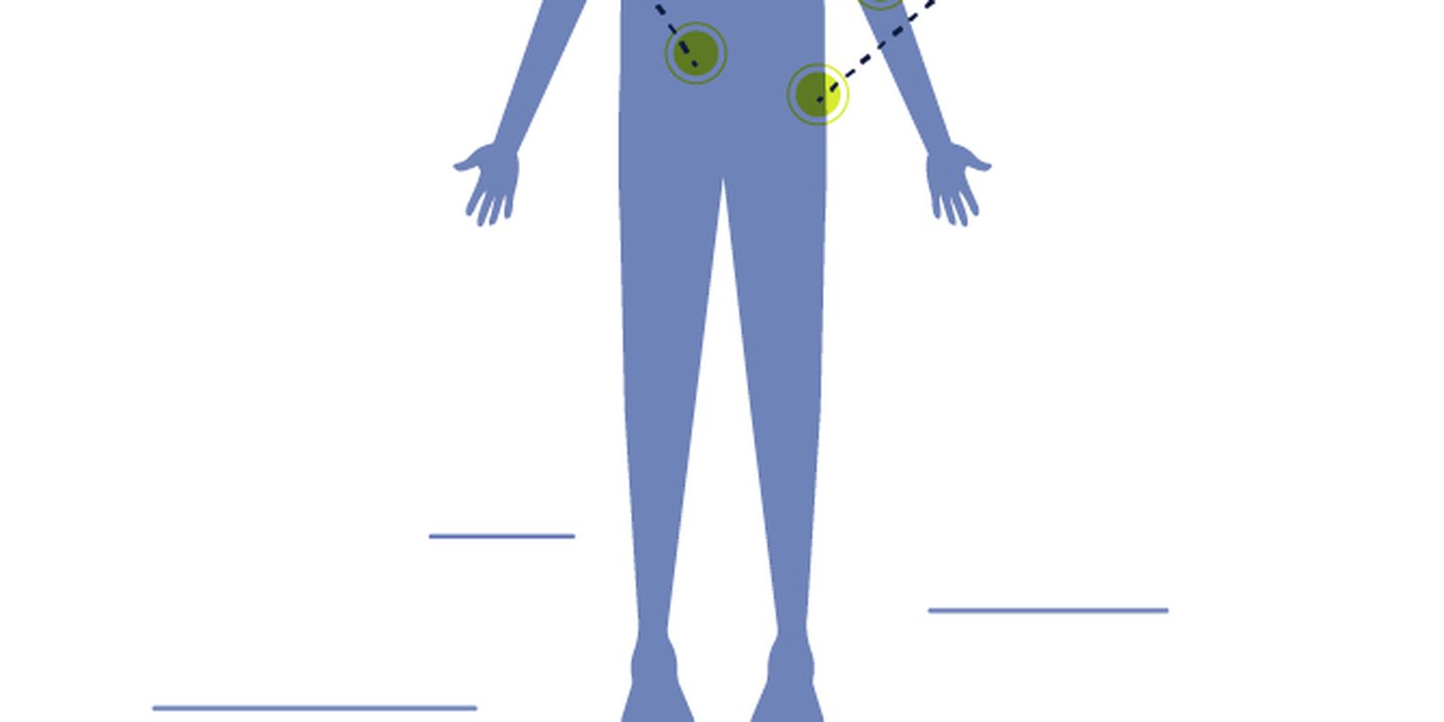 pacientes-com-neuroblastoma-aguardam-inclusao-de-medicamento-no-sus
