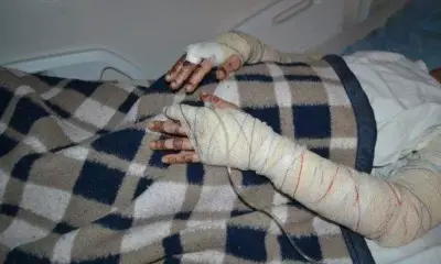 namorado-que-ateou-fogo-em-mulher-tem-prisao-preventiva-decretada-em-agua-clara