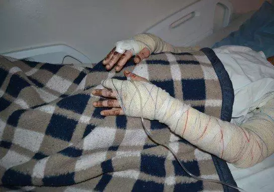 namorado-que-ateou-fogo-em-mulher-tem-prisao-preventiva-decretada-em-agua-clara