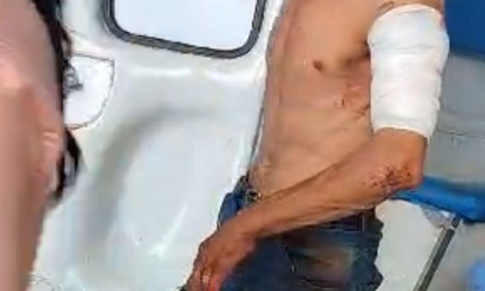 homem-e-esfaqueado-pela-ex-sogra-da-esposa-em-anastacio