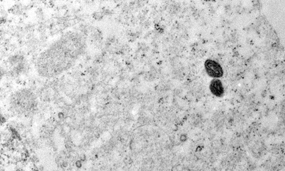 argentina-descarta-mpox-em-tripulante-de-navio-que-saiu-do-brasil