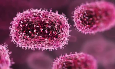 casos-de-mpox-no-brasil-este-ano-ja-superam-o-total-de-2023-–-folha-de-dourados-–-noticias-de-dourados-ms-e-regiao