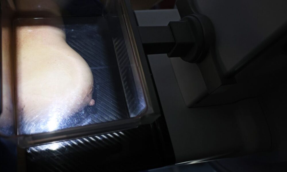 medicos-reafirmam-eficacia-da-mamografia-para-prevenir-cancer-de-mama