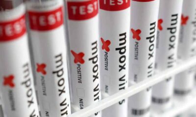 brasil-contabiliza-1,5-mil-casos-de-mpox-em-2024