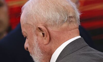 lula-fara-novo-procedimento-medico-nesta-quinta
