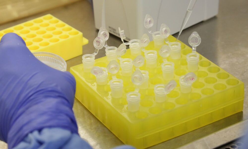 rio-confirma-dois-casos-de-sarampo-na-baixada-fluminense