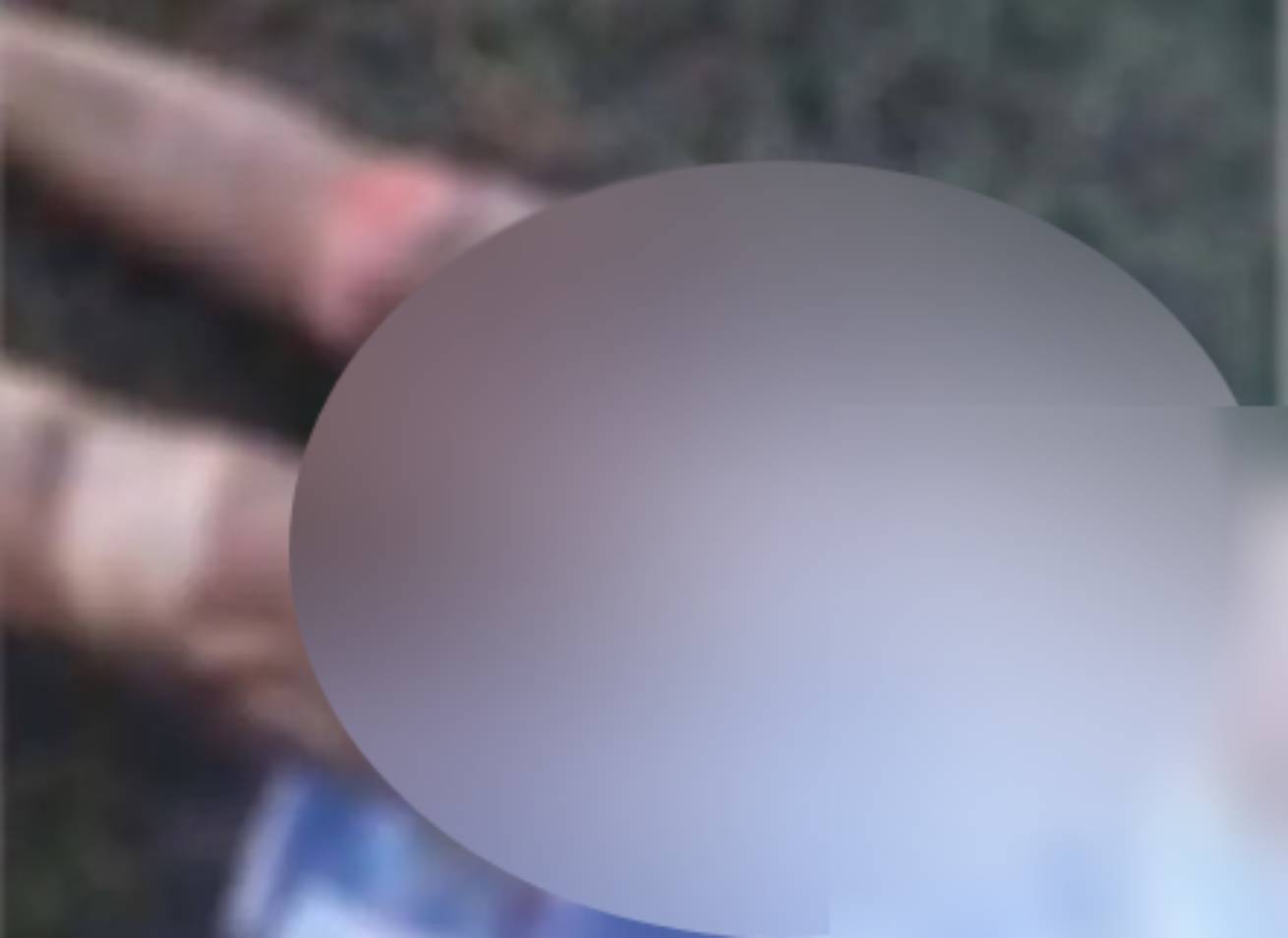 mulher-tem-o-corpo-incendiado-pelo-marido-em-fazenda-no-pantanal