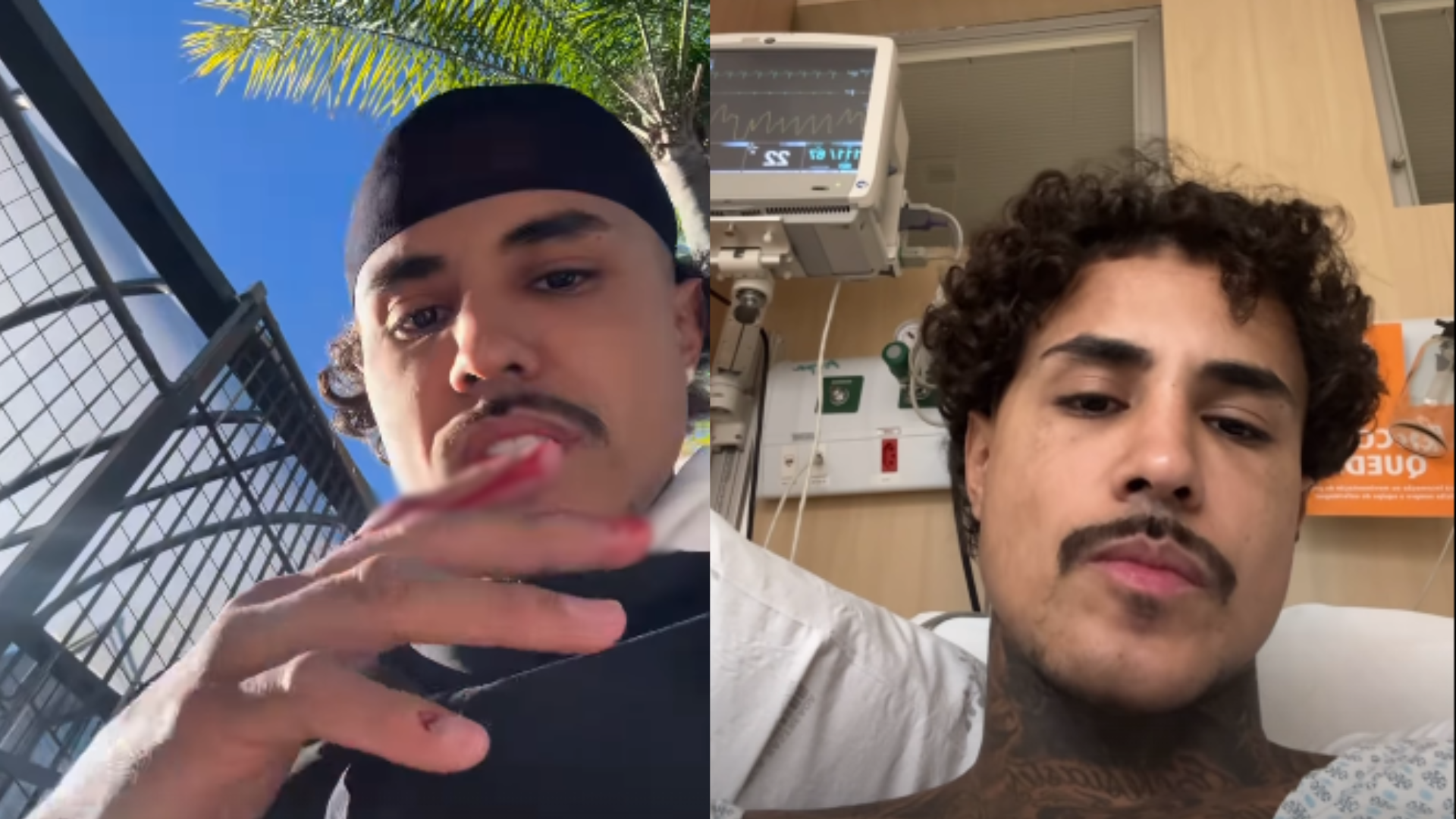 mc-livinho-sofre-acidente-de-moto,-perfura-pulmao-e-e-internado-em-uti-em-sao-paulo