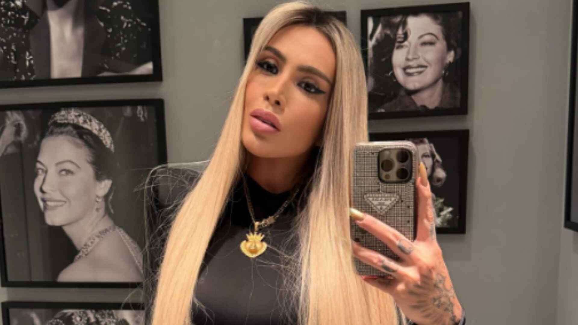 juju-ferrari-e-internada-com-possivel-infeccao-por-aplicacoes-de-hidrogel-nos-gluteos