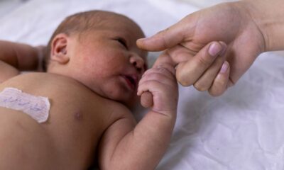 teste-do-olhinho-deve-ser-repetido-tres-vezes-ao-ano-ate-os-3-anos