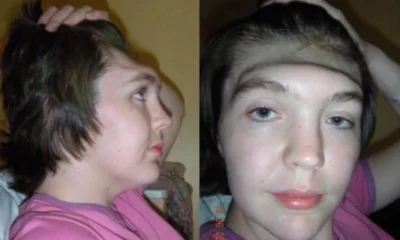 mulher-perde-parte-do-cranio-apos-acidente-–-folha-de-dourados-–-noticias-de-dourados-ms-e-regiao