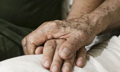 demencia-por-corpos-de-lewy:-entenda-doenca-de-milton-nascimento