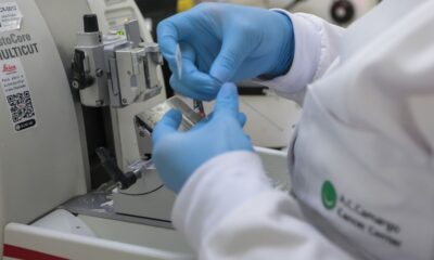 cura-de-cancer-de-prostata-pode-chegar-a-ate-98% 