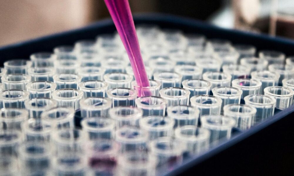 estudo-mostra-que-inflamacao-no-cerebro-pode-ser-chave-do-alzheimer