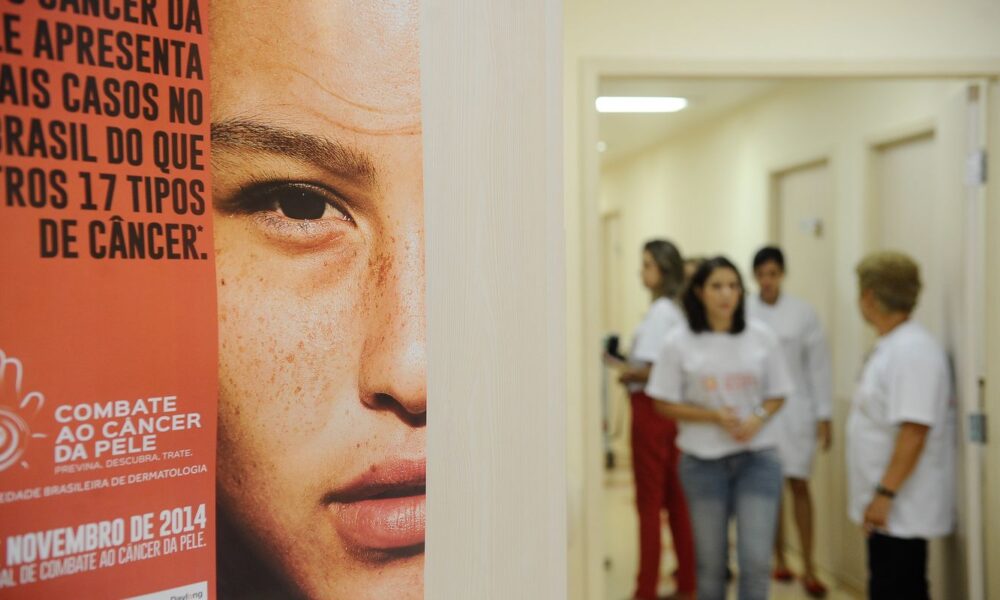 casos-de-cancer-de-pele-saltam-de-4-mil-para-mais-de-72-mil-em-10-anos