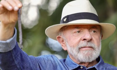 lula-vai-a-sp-para-tirar-excesso-de-pele-na-cabeca-e-tratar-tendinite