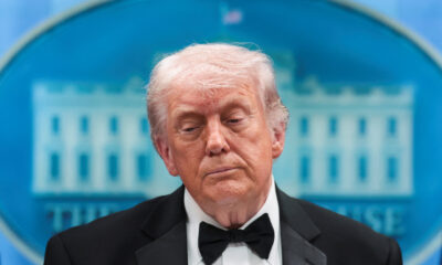 trump:-“excelente-estado-de-saude,-com-inchaco-nas-pernas-e-hematomas”,-diz-medico